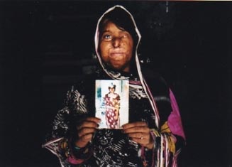 林典子写真展 硫酸に焼かれた人生 パキスタンの女性たち 新宿ニコンサロン デジカメ Watch Watch